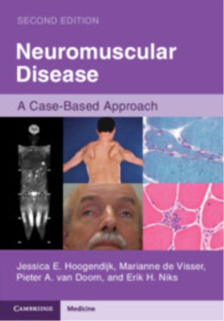 Neuromuscular Disease - A Case-Based Approach
