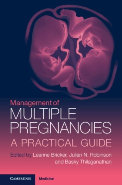 Management of Multiple Pregnancies - A Practical Guide