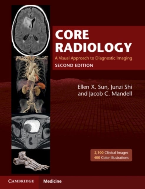 Core Radiology - A Visual Approach to Diagnostic Imaging