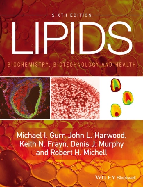 Lipids - Biochemistry, Biotechnology and Health 6e - Biochemistry, Biotechnology and Health