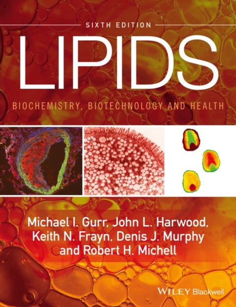 Lipids - Biochemistry, Biotechnology and Health 6e - Biochemistry, Biotechnology and Health