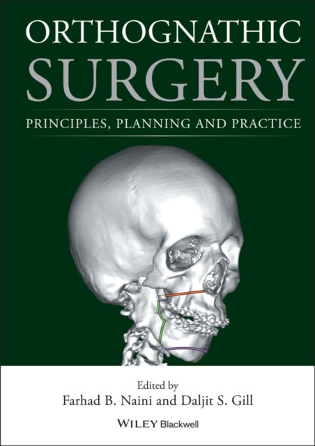 Orthognathic Surgery - Principles, Planning and Practice