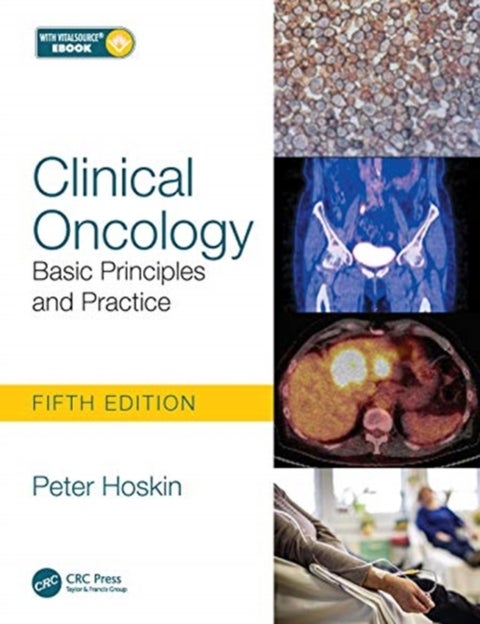 Clinical Oncology - Basic Principles and Practice