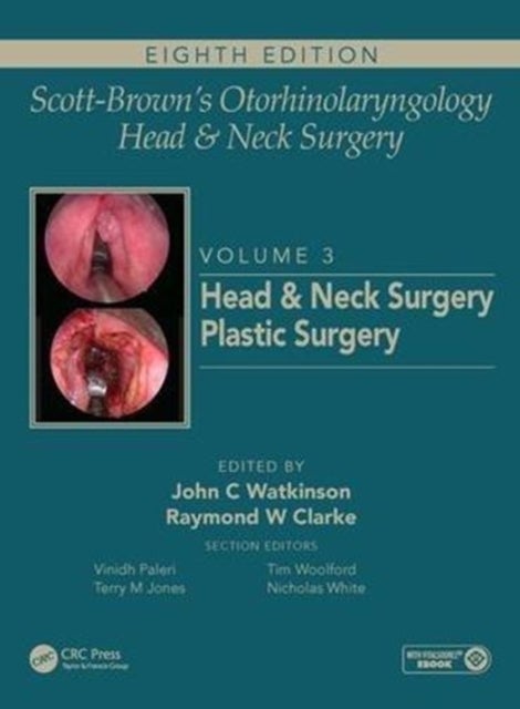Scott-Brown's Otorhinolaryngology and Head and Neck Surgery - Volume 3: Head and Neck Surgery, Plastic Surgery
