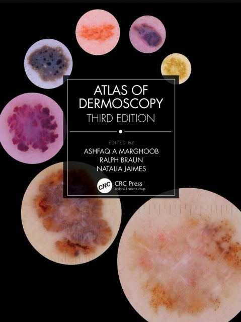 Atlas of Dermoscopy - Third Edition