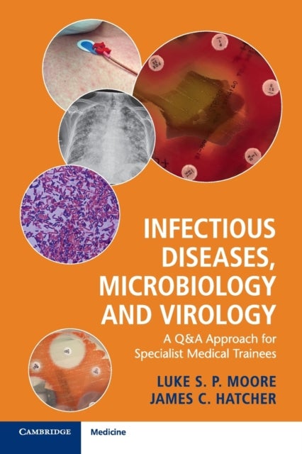 Infectious Diseases, Microbiology and Virology - A Q&A Approach for Specialist Medical Trainees