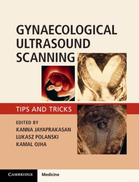 Gynaecological Ultrasound Scanning - Tips and Tricks