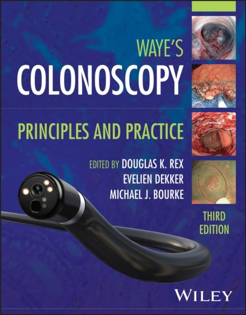 Colonoscopy - Principles and Practice