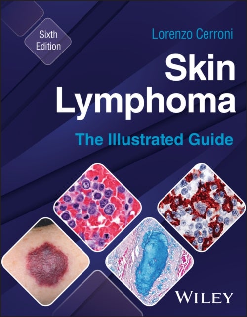 Skin Lymphoma - The Illustrated Guide