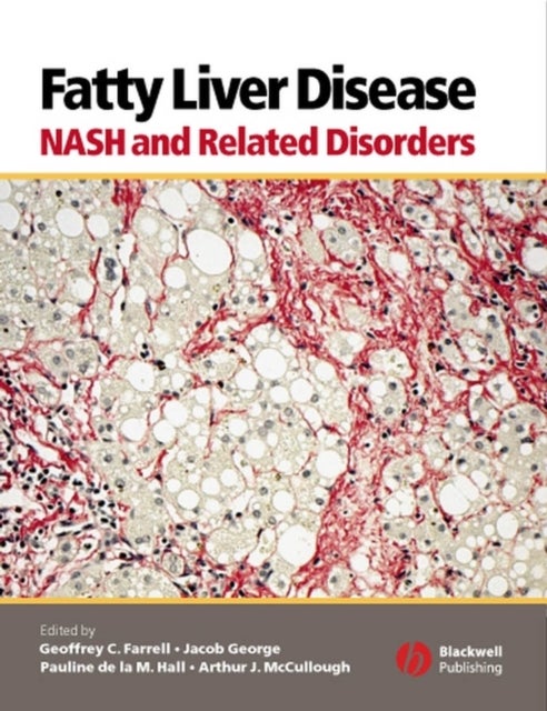 Fatty Liver Disease - NASH and Related Disorders