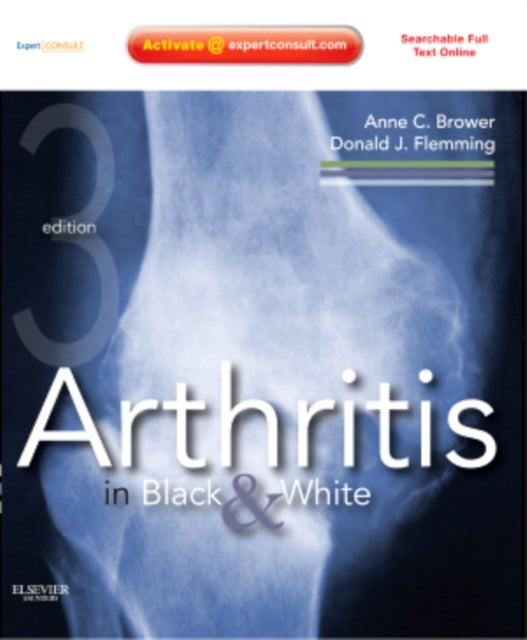 Arthritis in Black and White - Expert Consult - Online and Print