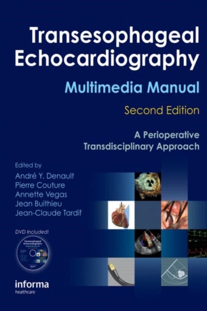 Transesophageal Echocardiography Multimedia Manual - A Perioperative Transdisciplinary Approach