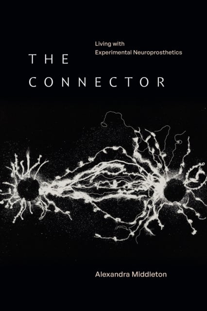 The Connector - Living with Experimental Neuroprosthetics