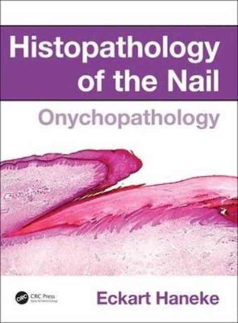 Histopathology of the Nail - Onychopathology