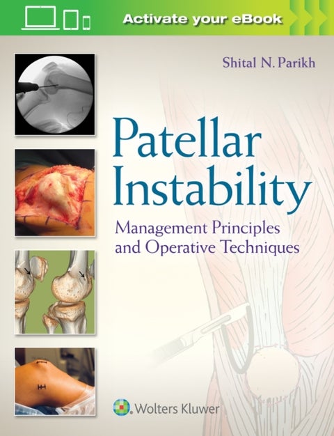 Patellar Instability - Management Principles and Operative Techniques