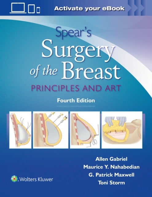 Spear's Surgery of the Breast - Principles and Art