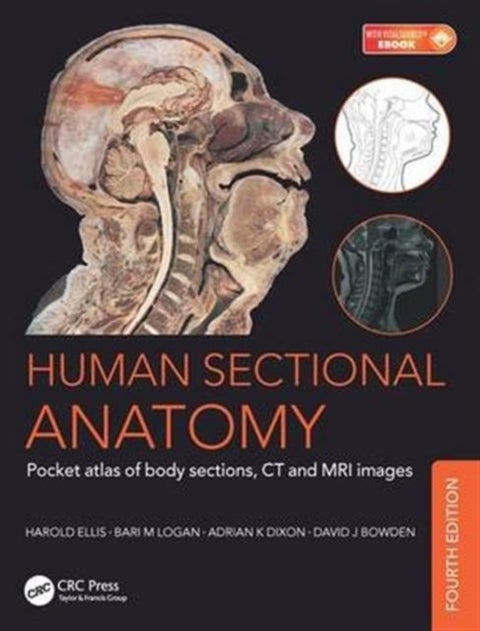 Human Sectional Anatomy - Pocket atlas of body sections, CT and MRI images, Fourth edition