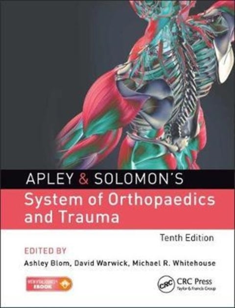 Apley & Solomon's System of Orthopaedics and Trauma