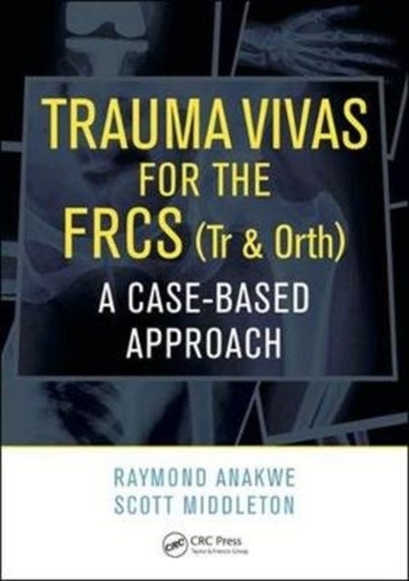 Trauma Vivas for the FRCS - A Case-Based Approach