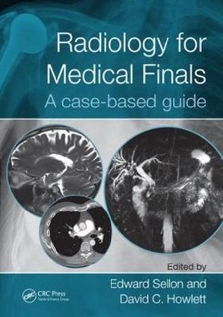 Radiology for Medical Finals - A case-based guide