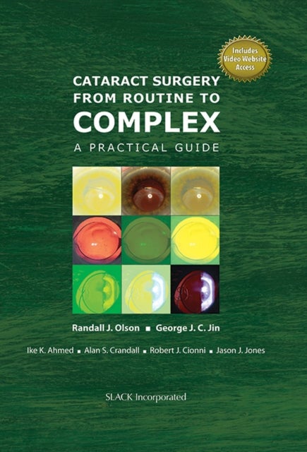Cataract Surgery from Routine to Complex - A Practical Guide