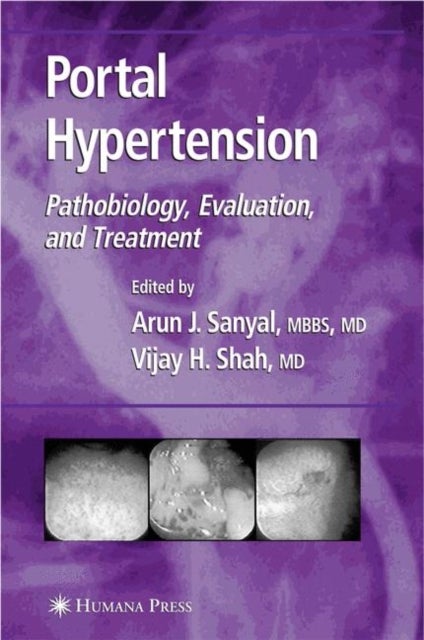 Portal Hypertension - Pathobiology, Evaluation, and Treatment