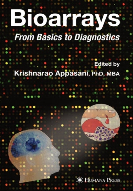 Bioarrays - From Basics to Diagnostics