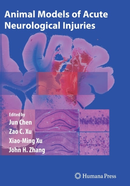 Animal Models of Acute Neurological Injuries