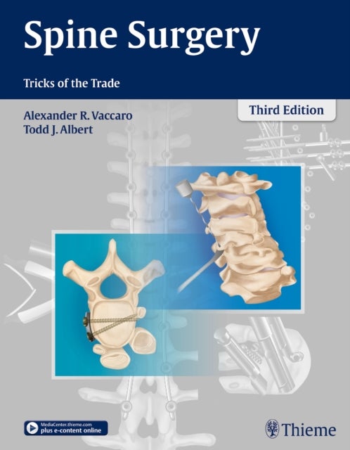 Spine Surgery - Tricks of the Trade