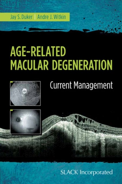 Age-Related Macular Degeneration - Current Management