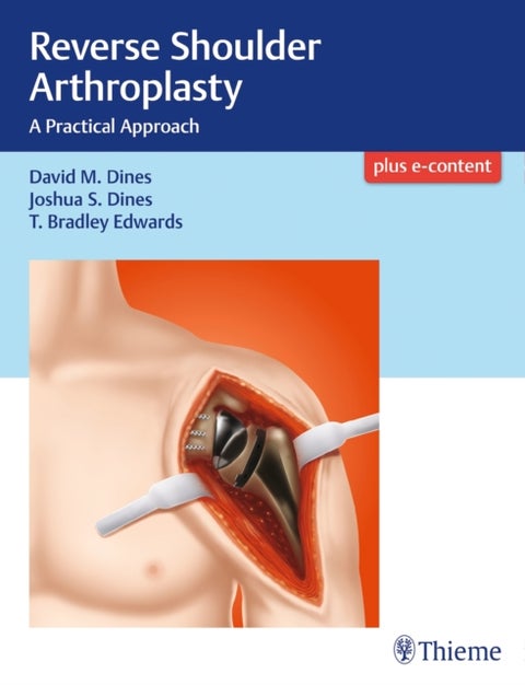 Reverse Shoulder Arthroplasty - A Practical Approach