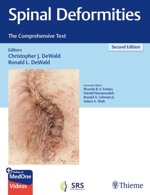 Spinal Deformities - The Comprehensive Text
