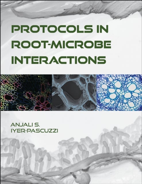 Protocols in Root-Microbe Interactions