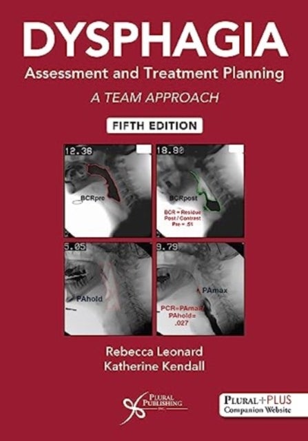 Dysphagia Assessment and Treatment Planning - A Team Approach