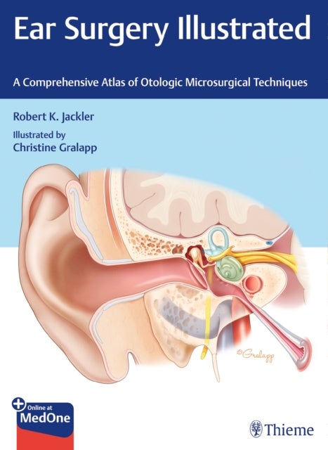 Ear Surgery Illustrated - A Comprehensive Atlas of Otologic Microsurgical Techniques