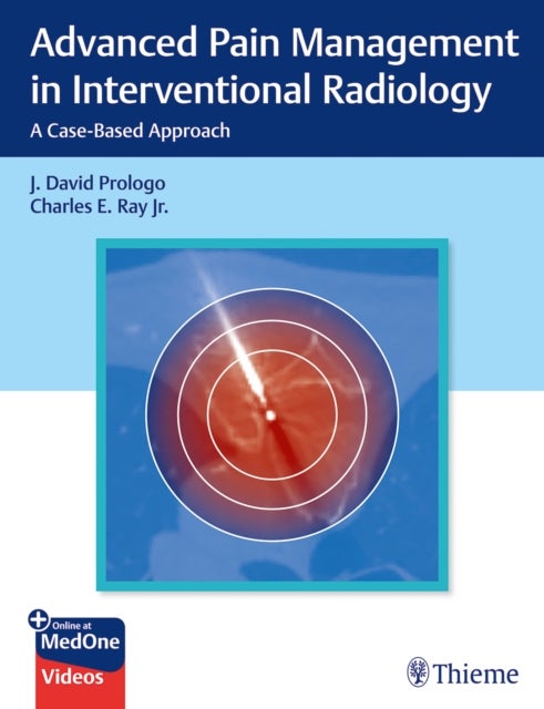 Advanced Pain Management in Interventional Radiology - A Case-Based Approach