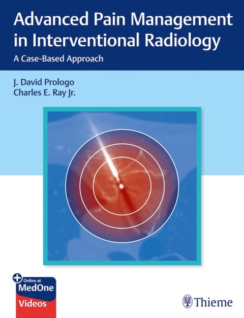 Advanced Pain Management in Interventional Radiology - A Case-Based Approach