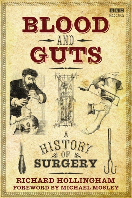 Blood and Guts - A History of Surgery