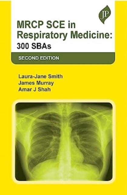 MRCP SCE in Respiratory Medicine - 300 SBAs