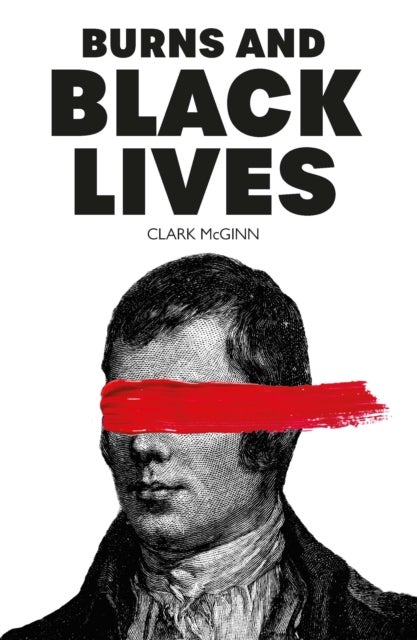 Burns and Black Lives
