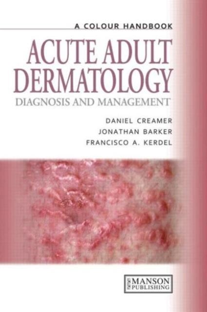 Acute Adult Dermatology - Diagnosis and Management: A Colour Handbook