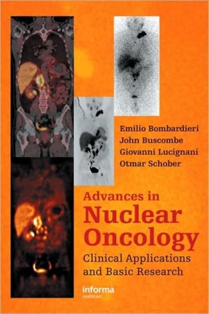 Advances in Nuclear Oncology: - Diagnosis and Therapy