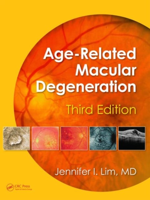 Age-Related Macular Degeneration