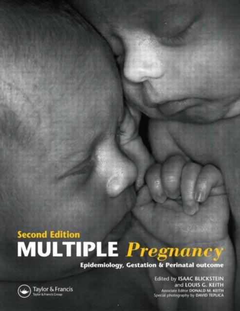 Multiple Pregnancy - Epidemiology, Gestation, and Perinatal Outcome