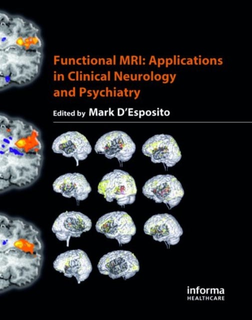 Functional MRI - Applications in Clinical Neurology and Psychiatry