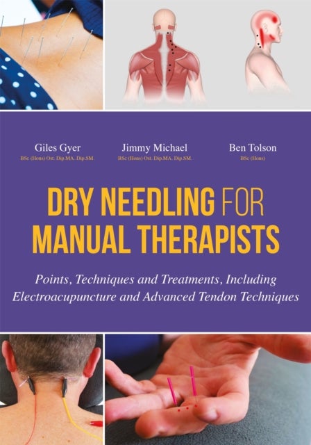Dry Needling for Manual Therapists - Points, Techniques and Treatments, Including Electroacupuncture and Advanced Tendon Techniques