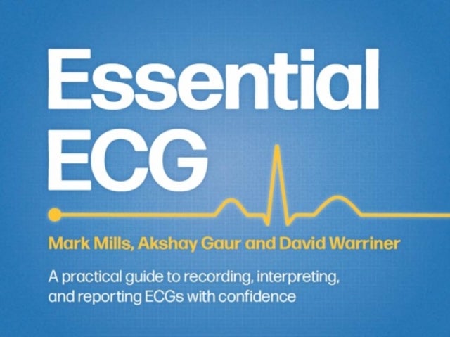 Essential ECG - A practical guide to recording, interpreting, and reporting ECGs with confidence