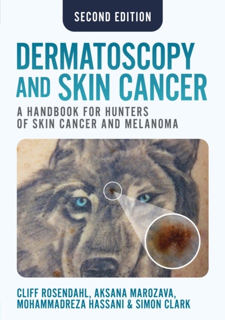 Dermatoscopy and Skin Cancer, second edition - A handbook for hunters of skin cancer and melanoma