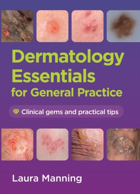 Dermatology Essentials for General Practice - Clinical Gems and Practical Tips