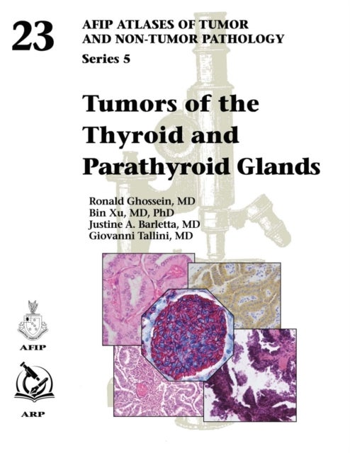 Tumors of the Thyroid and Parathyroid Glands